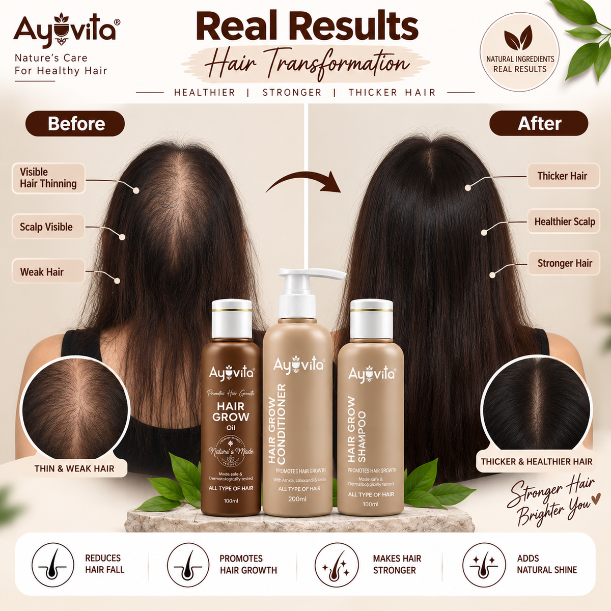 Ayuvita Hair Growth Kit – Hair Grow Oil, Shampoo & Conditioner
