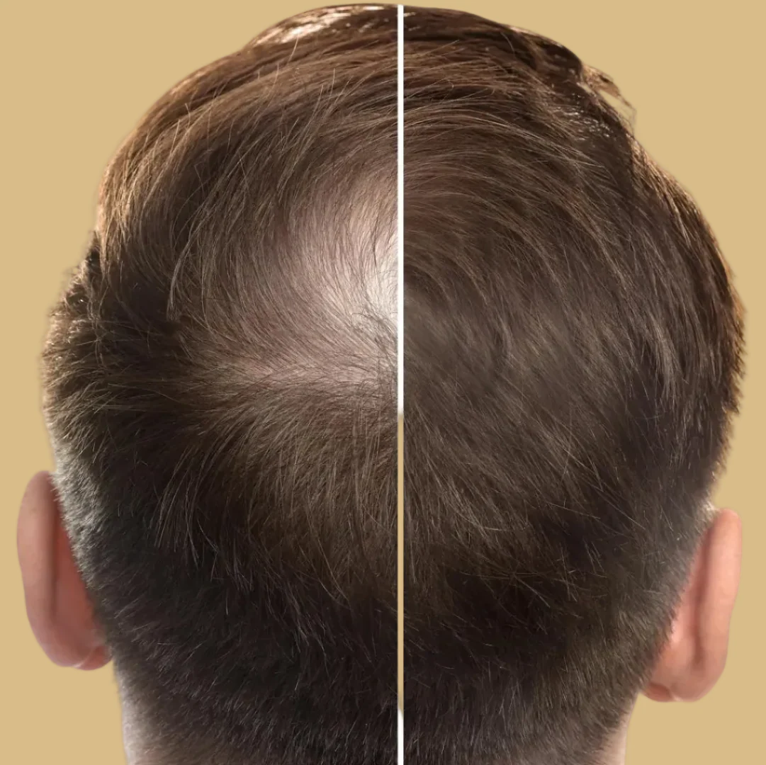 Hair Growth