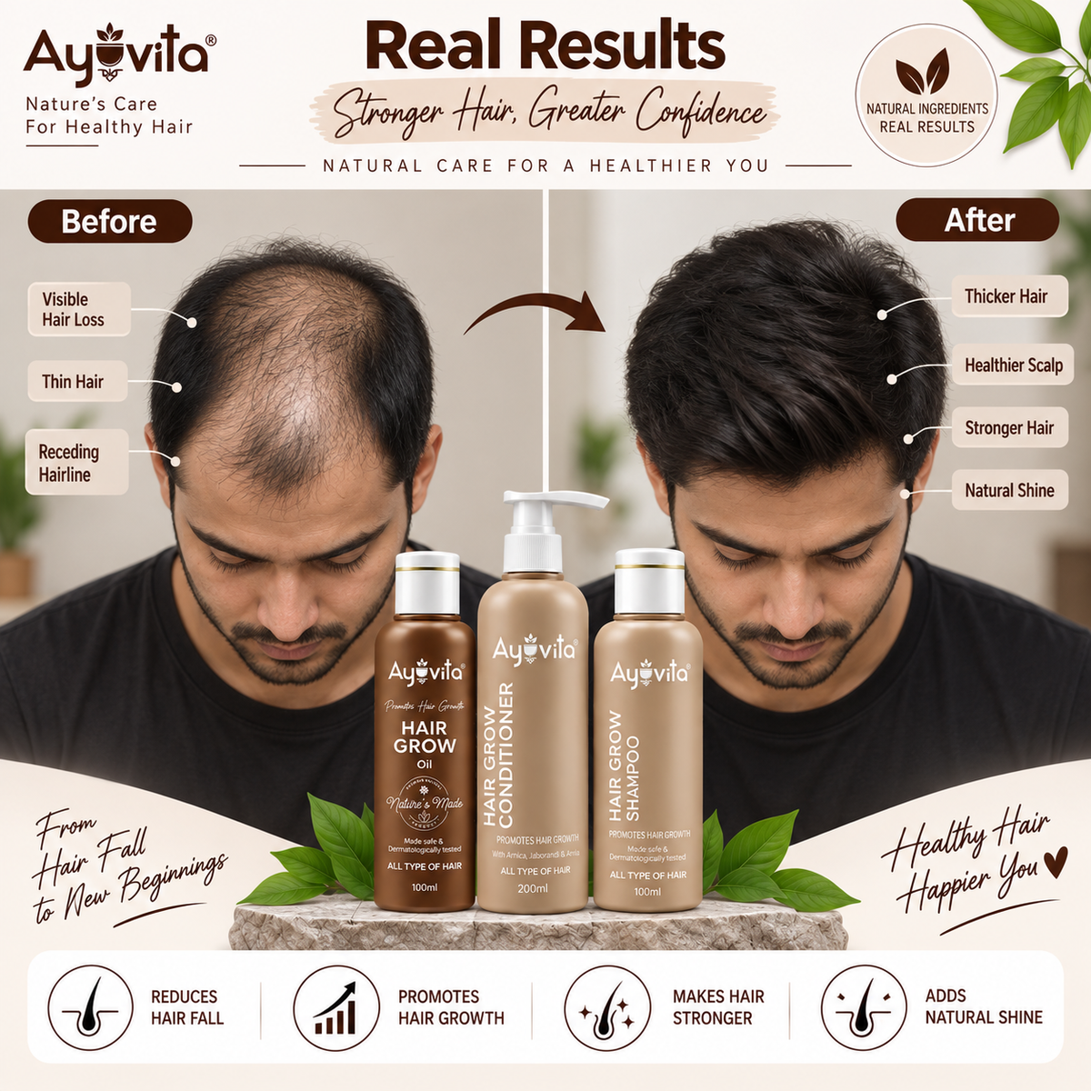 Ayuvita Hair Growth Kit – Hair Grow Oil, Shampoo & Conditioner